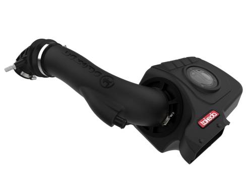 aFe Power - 56-70032D | Takeda Momentum Cold Air Intake System w/ Pro DRY S Filter 2018-2021 Kona L4-1.6L (t)